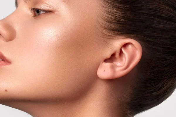 Jawline Dolgu