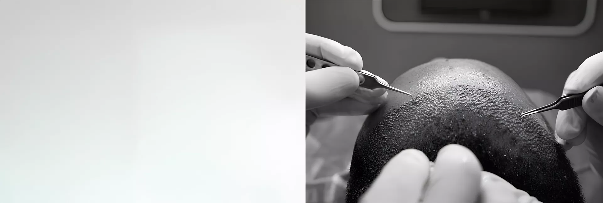Banner Görseli